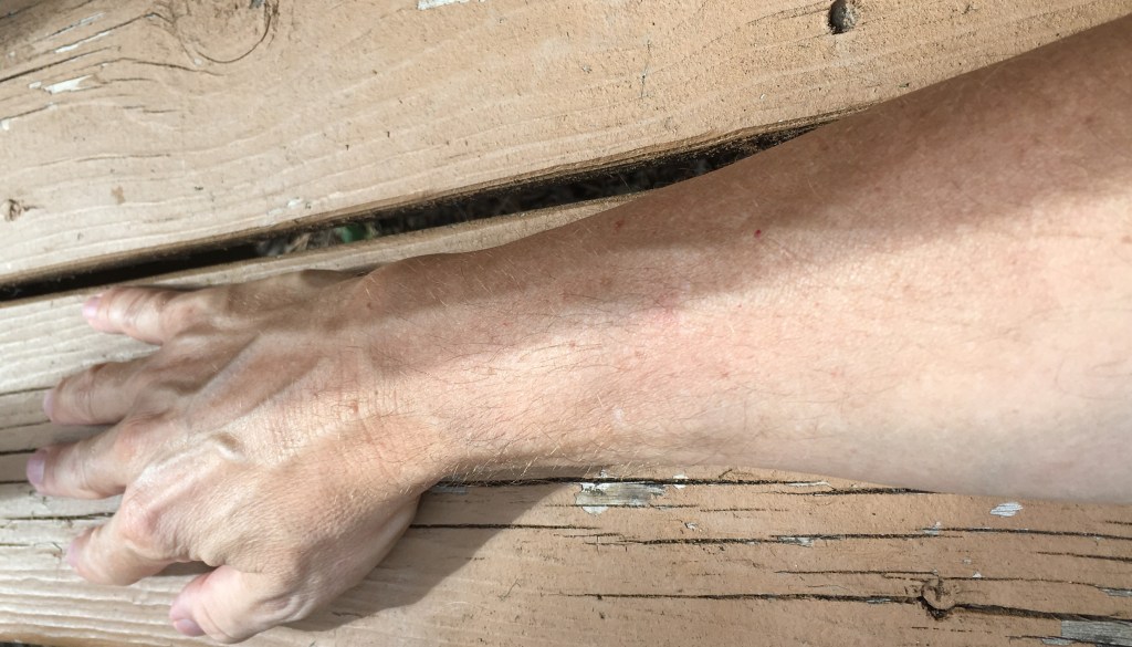 If you live long enough